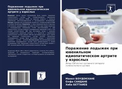 Cover Porazhenie lodyzhek pri üwenil'nom idiopaticheskom artrite u wzroslyh