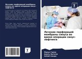 Lechenie perforacij membrany sinusa wo wremq operacii sinus-liftinga Lechenie perforacij membrany sinusa wo wremq operacii sinus-liftinga