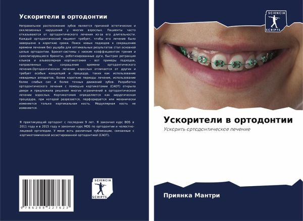 Uskoriteli w ortodontii Uskoriteli w ortodontii