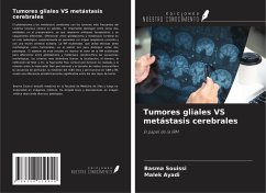 Tumores gliales VS metástasis cerebrales - Souissi, Basma; Ayadi, Malek