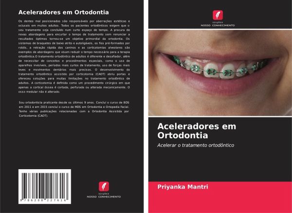 Aceleradores em Ortodontia