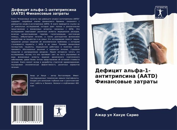 Deficit al'fa-1-antitripsina (AATD) Finansowye zatraty