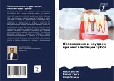 Oslozhneniq i neudachi pri implantacii zubow Oslozhneniq i neudachi pri implantacii zubow