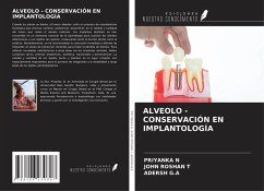 ALVEOLO - CONSERVACIÓN EN IMPLANTOLOGÍA - N, Priyanka; Roshan T, John; G. A, Adersh ALVEOLO - CONSERVACIÓN EN IMPLANTOLOGÍA - N, Priyanka; Roshan T, John; G. A, Adersh