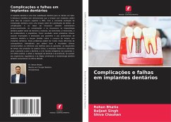 Complicações e falhas em implantes dentários - Bhatia, Rohan;Singh, Baljeet;Chauhan, Shiva