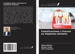 Cover Complicaciones y fracaso en implantes dentales