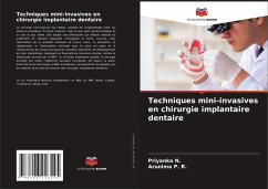 Techniques mini-invasives en chirurgie implantaire dentaire - N., Priyanka;P. R., Arunima