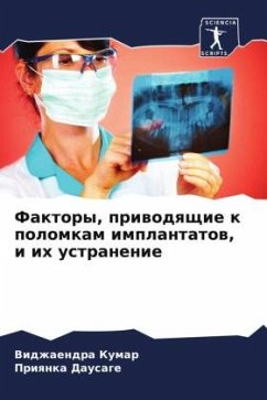 Faktory, priwodqschie k polomkam implantatow, i ih ustranenie - Kumar, Vidzhaendra;Dausage, Priqnka