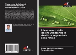 Cover Rilevamento delle lesioni utilizzando la struttura segmentata della retina