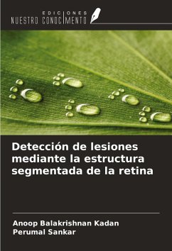Cover Detección de lesiones mediante la estructura segmentada de la retina