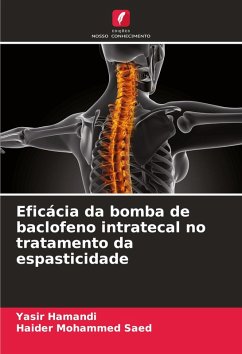 Eficácia da bomba de baclofeno intratecal no tratamento da espasticidade - Hamandi, Yasir;Saed, Haider Mohammed