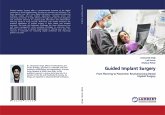 Guided Implant Surgery Guided Implant Surgery