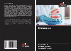 Cover Endocrown