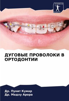 Cover DUGOVYE PROVOLOKI V ORTODONTII