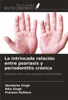 La intrincada relación entre psoriasis y periodontitis crónica - Singh, Akanksha; Singh, Rika; Rathore, Praveen