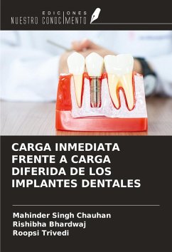 Cover CARGA INMEDIATA FRENTE A CARGA DIFERIDA DE LOS IMPLANTES DENTALES