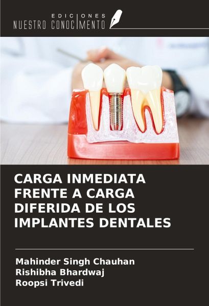 CARGA INMEDIATA FRENTE A CARGA DIFERIDA DE LOS IMPLANTES DENTALES
