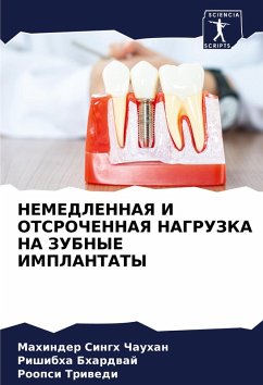Cover NEMEDLENNAYa I OTSROChENNAYa NAGRUZKA NA ZUBNYE IMPLANTATY