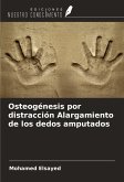 Osteogénesis por distracción Alargamiento de los dedos amputados