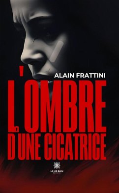 L'ombre d'une cicatrice (eBook, ePUB) - Frattini, Alain