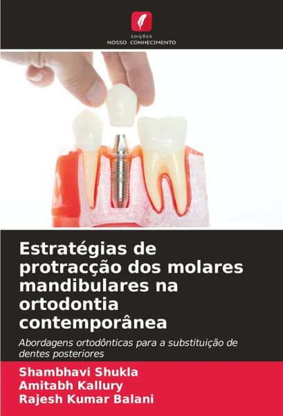 Estratégias de protracção dos molares mandibulares na ortodontia contemporânea Estratégias de protracção dos molares mandibulares na ortodontia contemporânea