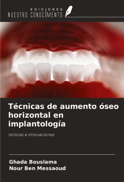 Técnicas de aumento óseo horizontal en implantología - Bouslama, Ghada; Ben Messaoud, Nour