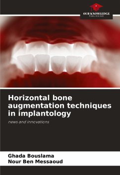 Horizontal bone augmentation techniques in implantology - Bouslama, Ghada;Ben Messaoud, Nour