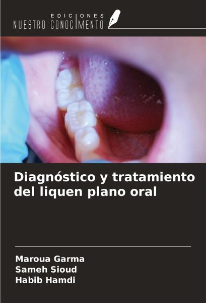 Diagnóstico y tratamiento del liquen plano oral Diagnóstico y tratamiento del liquen plano oral