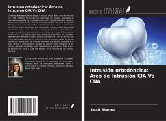 Intrusión ortodóncica: Arco de Intrusión CIA Vs CNA - Sharma, Swati