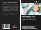 Ritenzione dei denti permanenti anteriori