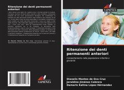 Cover Ritenzione dei denti permanenti anteriori