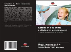 Cover Rétention des dents antérieures permanentes