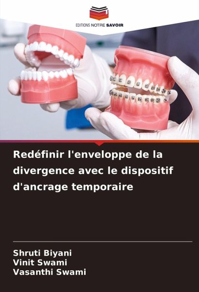 Redéfinir l'enveloppe de la divergence avec le dispositif d'ancrage temporaire Redéfinir l'enveloppe de la divergence avec le dispositif d'ancrage temporaire