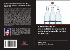 Caractérisation moléculaire des lésions à cellules claires de la tête et du cou - Jain, Anshi; Charan Shetty, Devi