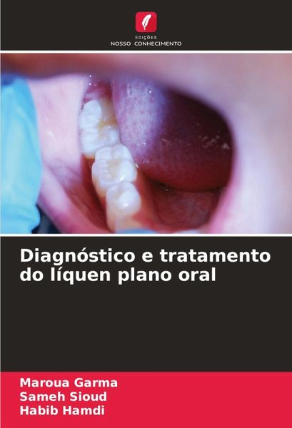Diagnóstico e tratamento do líquen plano oral Diagnóstico e tratamento do líquen plano oral