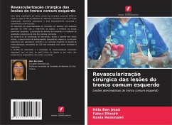 Cover Revascularização cirúrgica das lesões do tronco comum esquerdo