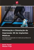 Otimização e Simulação da Impressão 3D de Implantes Médicos Otimização e Simulação da Impressão 3D de Implantes Médicos