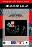 Colposcopia clínica (eBook, PDF) Colposcopia clínica (eBook, PDF)