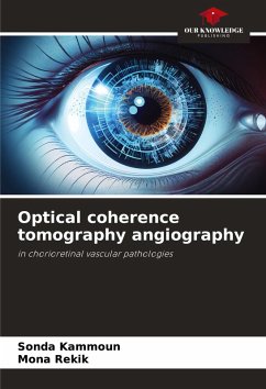 Cover Optical coherence tomography angiography
