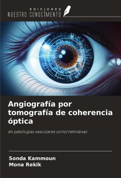 Angiografía por tomografía de coherencia óptica - Kammoun, Sonda; Rekik, Mona