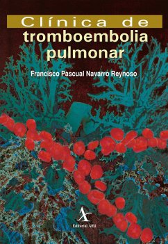 Cover Clínica de tromboembolia pulmonar (eBook, PDF)