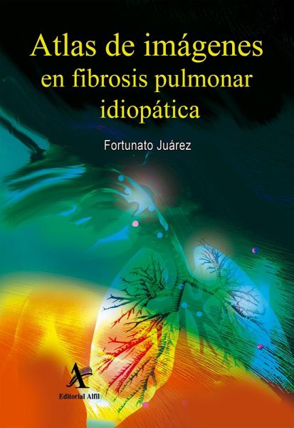 Atlas de imágenes en fibrosis pulmonar idiopática (eBook, PDF)