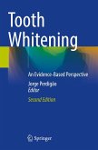 Tooth Whitening Tooth Whitening