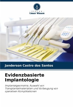 Evidenzbasierte Implantologie - Castro dos Santos, Janderson