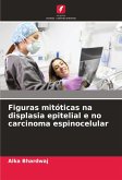 Figuras mitóticas na displasia epitelial e no carcinoma espinocelular Figuras mitóticas na displasia epitelial e no carcinoma espinocelular