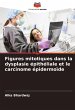 Figures mitotiques dans la dysplasie... - Bild 1