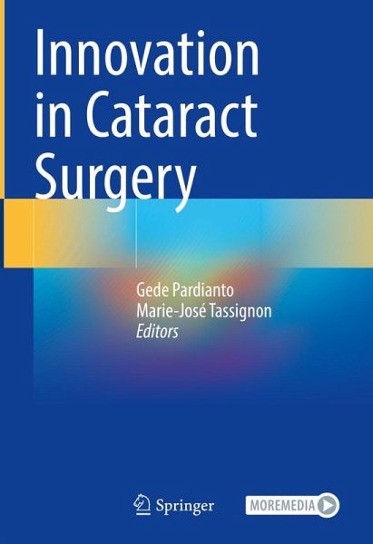 Innovation in Cataract Surgery (eBook, PDF)