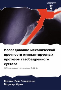 Cover Issledowanie mehanicheskoj prochnosti implantiruemyh protezow tazobedrennogo sustawa