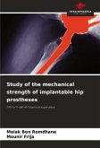 Study of the mechanical strength of implantable hip prostheses