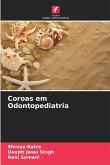 Coroas em Odontopediatria Coroas em Odontopediatria